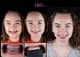 Slider image (7) NES Dental Clinic